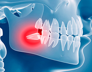 cirugia1 Cirugía oral