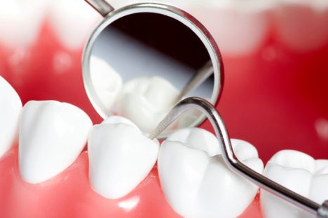 odontologia-conservadora Odontología conservadora